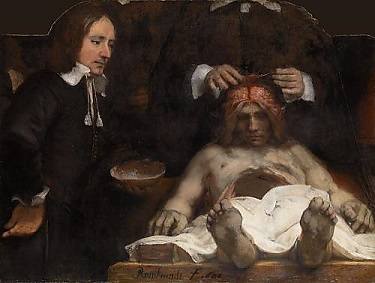 Rembrandt, Anatomische les van Dr. Deijman, 1656, olie op doek, fragment. Collectie Amsterdam Museum SA 7394